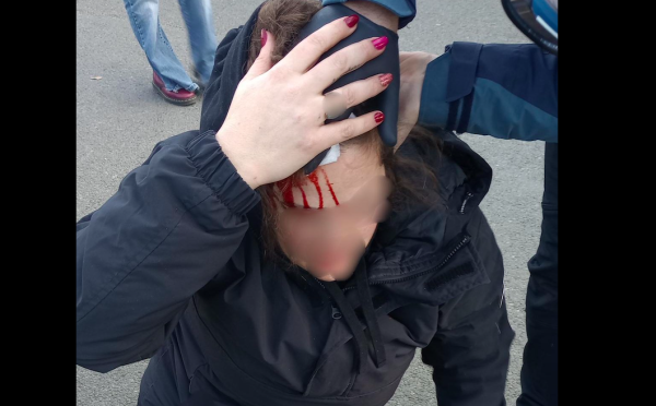 Nantes. Une femme enceinte blessée à la tête par un tir de grenade policier dans la manifestation